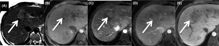 FIGURE 4