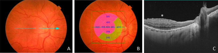 Fig. 1