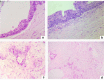 Fig. 14