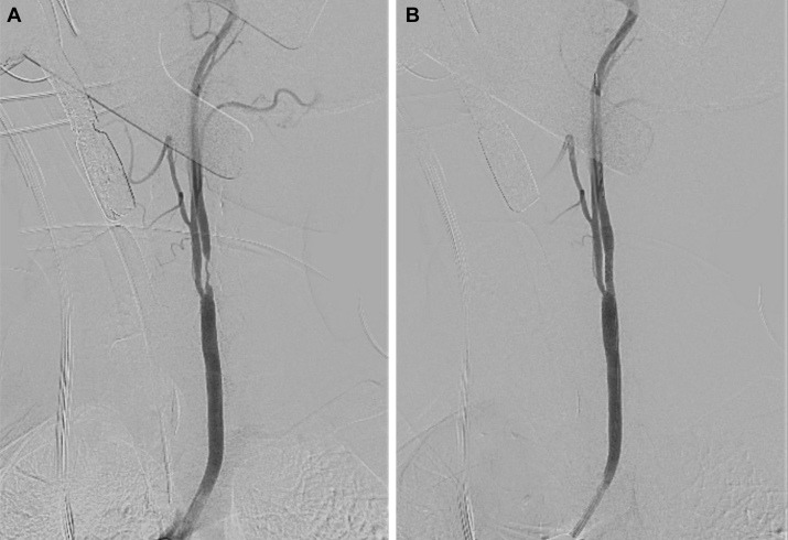 Fig 3