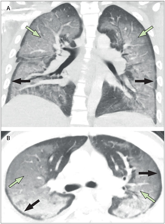 Figure 3: