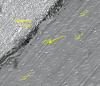 Micrograph 1