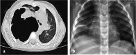 Fig. 10