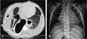 Fig. 9