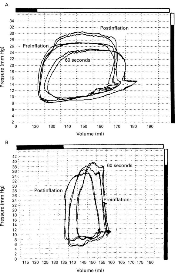 Figure 2  