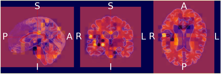 Fig. 16