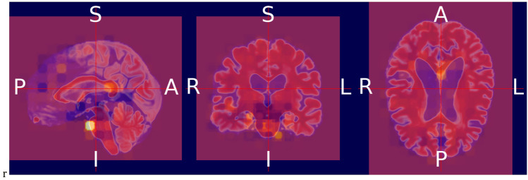 Fig. 13