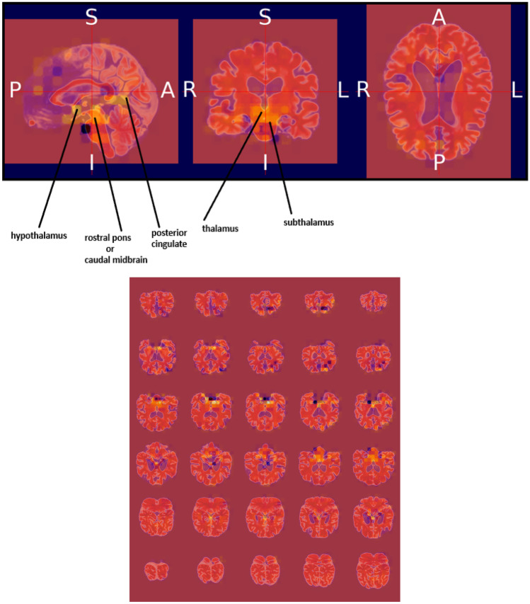 Fig. 14