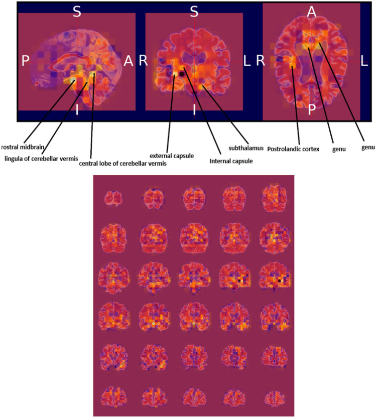 Fig. 17