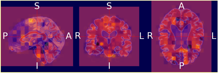 Fig. 15