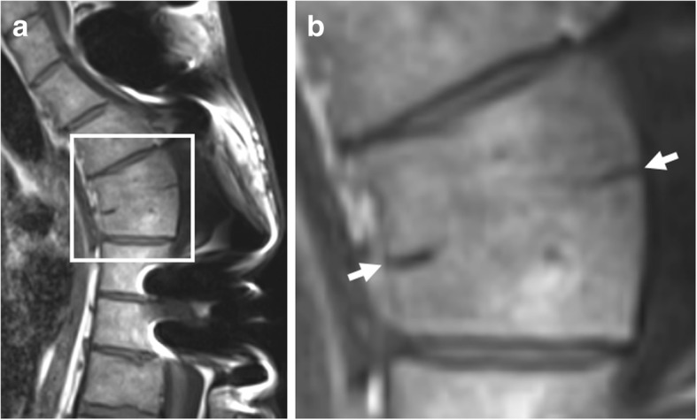 Fig. 13