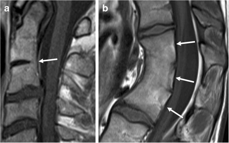 Fig. 11