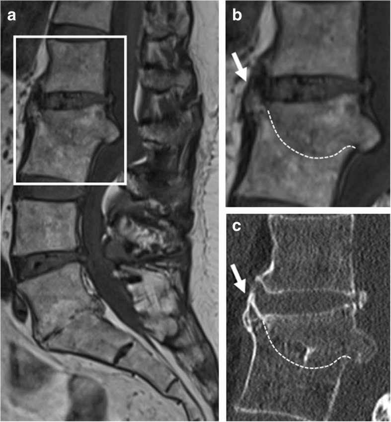 Fig. 12