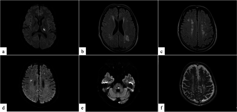 Fig. 2