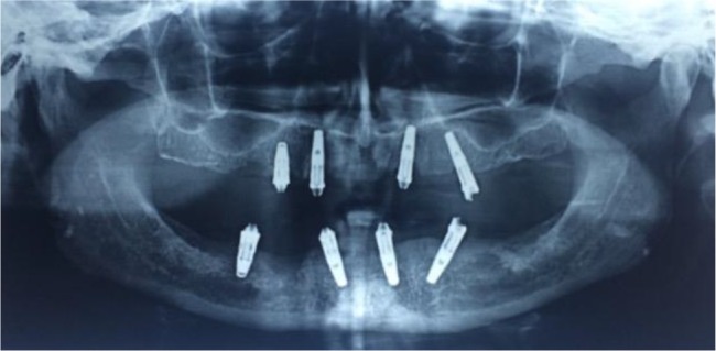 Fig. 2: