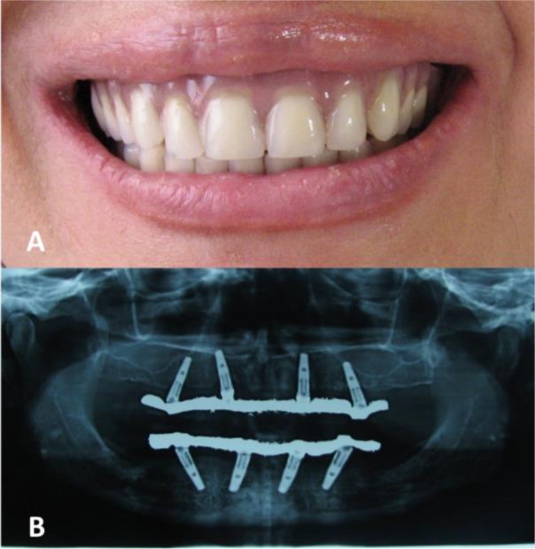 Fig. 1: