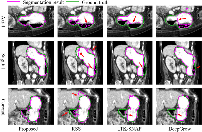 Fig. 13