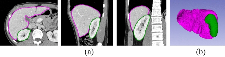 Fig. 7