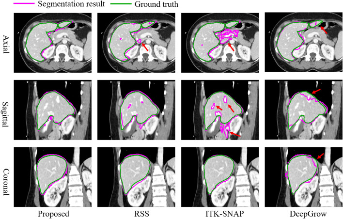 Fig. 12