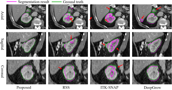 Fig. 14