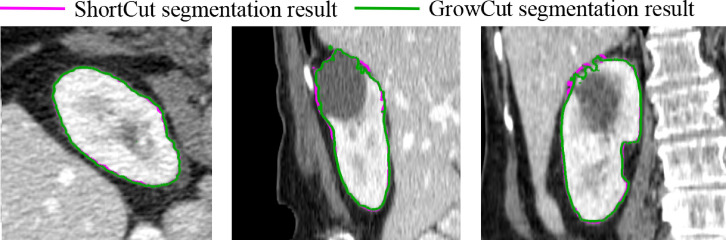 Fig. 9