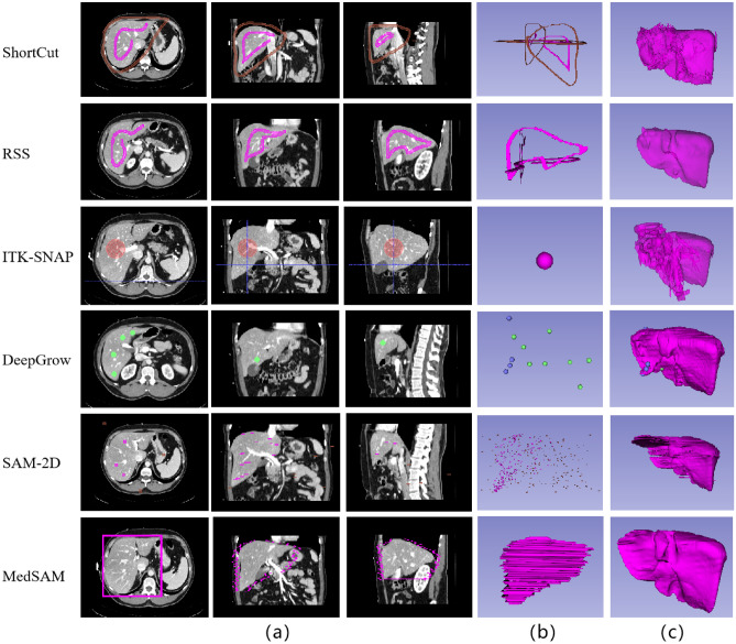 Fig. 11