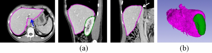 Fig. 5