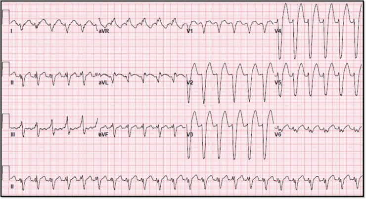 Figure 1: