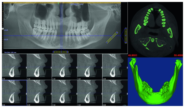 Figure 3