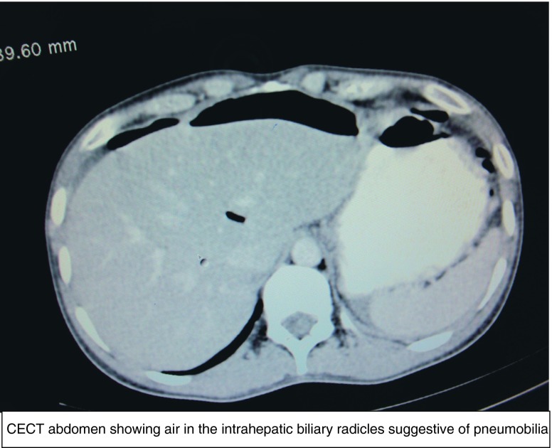 Fig.
                            1