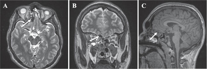 Fig. 3