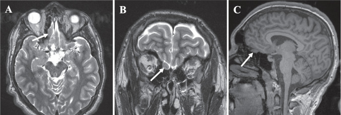 Fig. 1