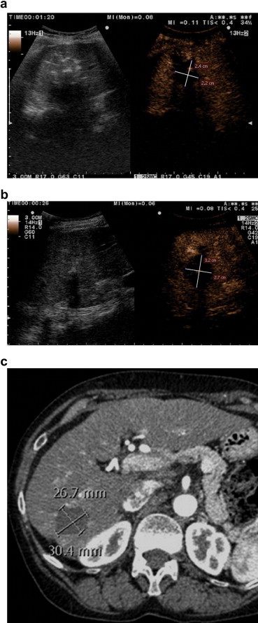 Figure 1