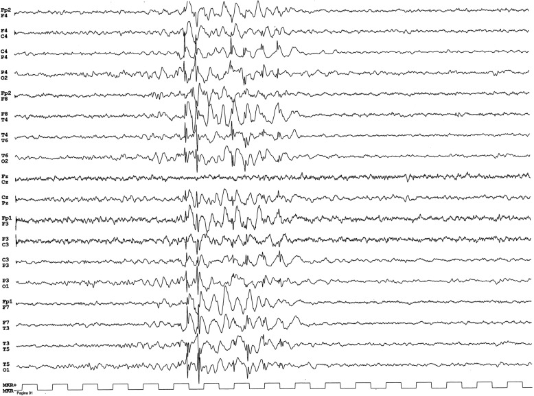 Fig. 1