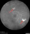 Figure 20