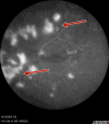 Figure 22