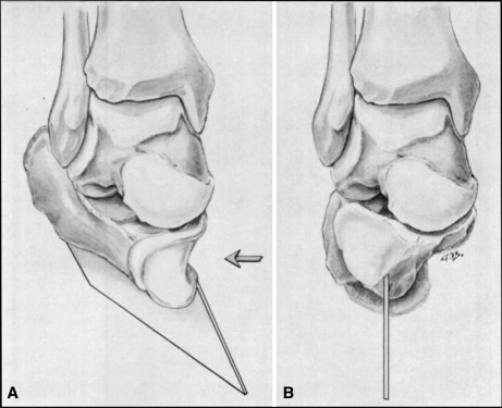 Fig. 1A–B