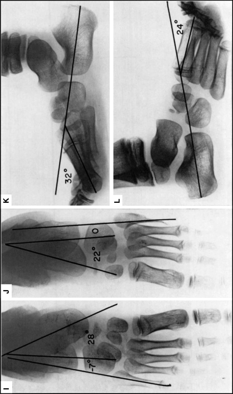 Fig. 3A–L