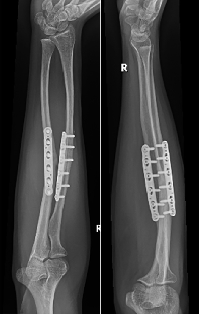 Fig. 10