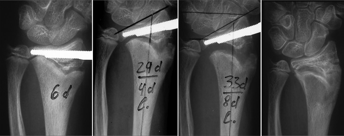 Fig. 16