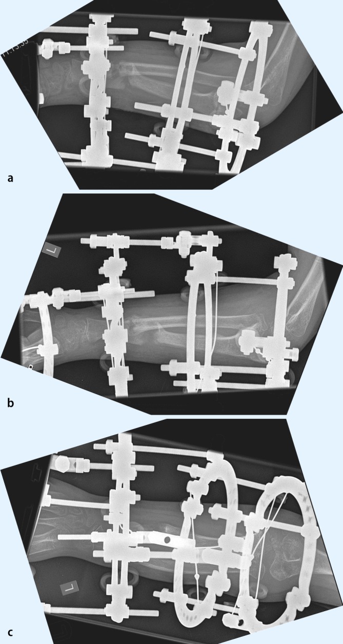 Fig. 12