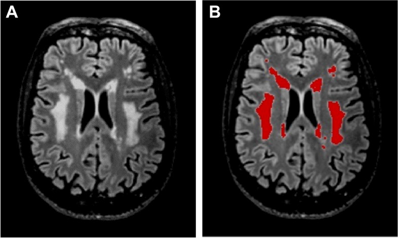 Fig. 1