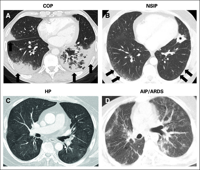 Fig 1.