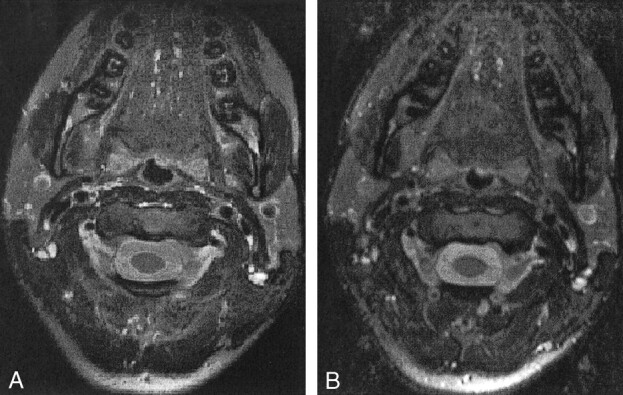 fig 6.