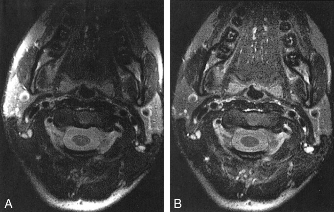 fig 4.