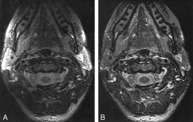 fig 5.