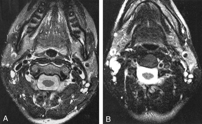 fig 8.