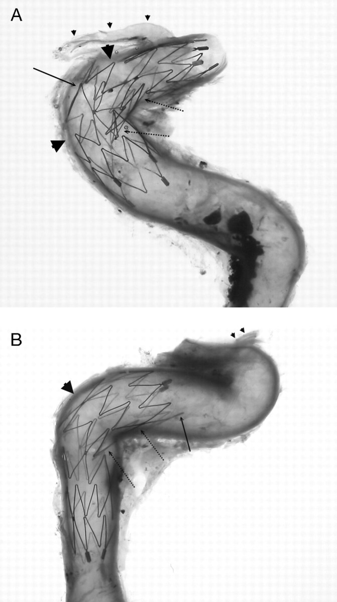 Fig 6.