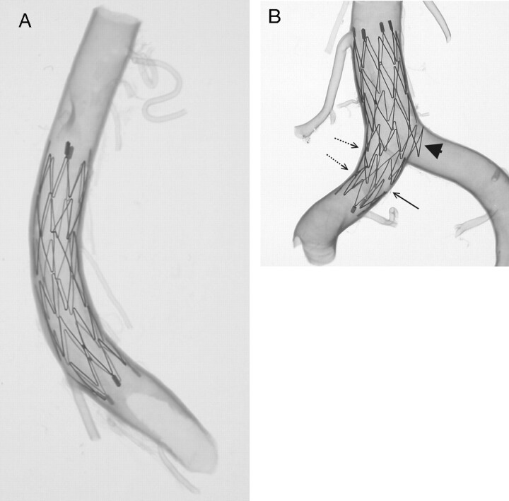 Fig 3.