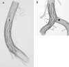 Fig 3.